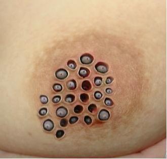 蓬莲乳图片,天然滋养，健康生活新选择